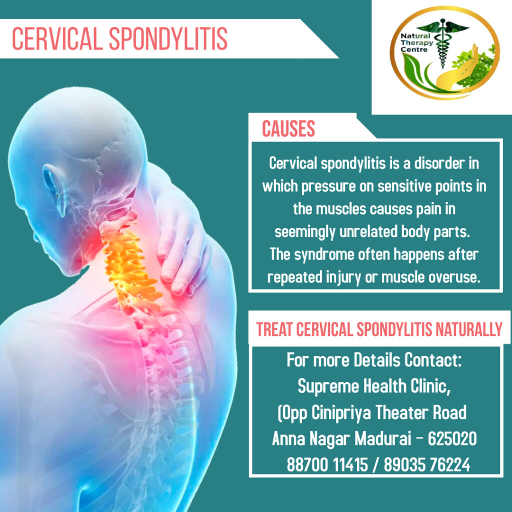 cervical spondylitis