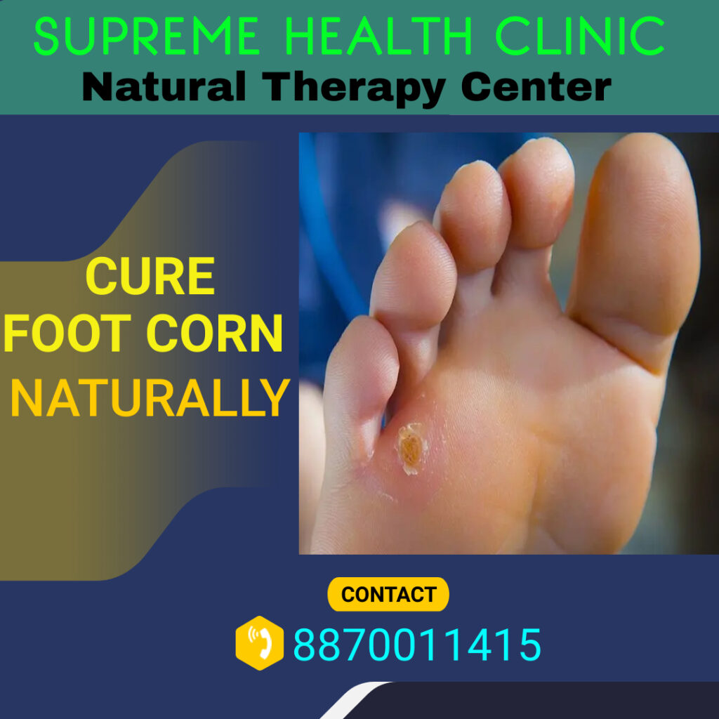 foot corn