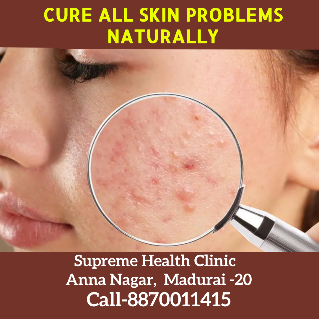 skin problem